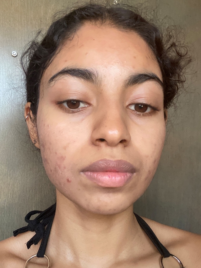 Karen Michelle C., 25 Before