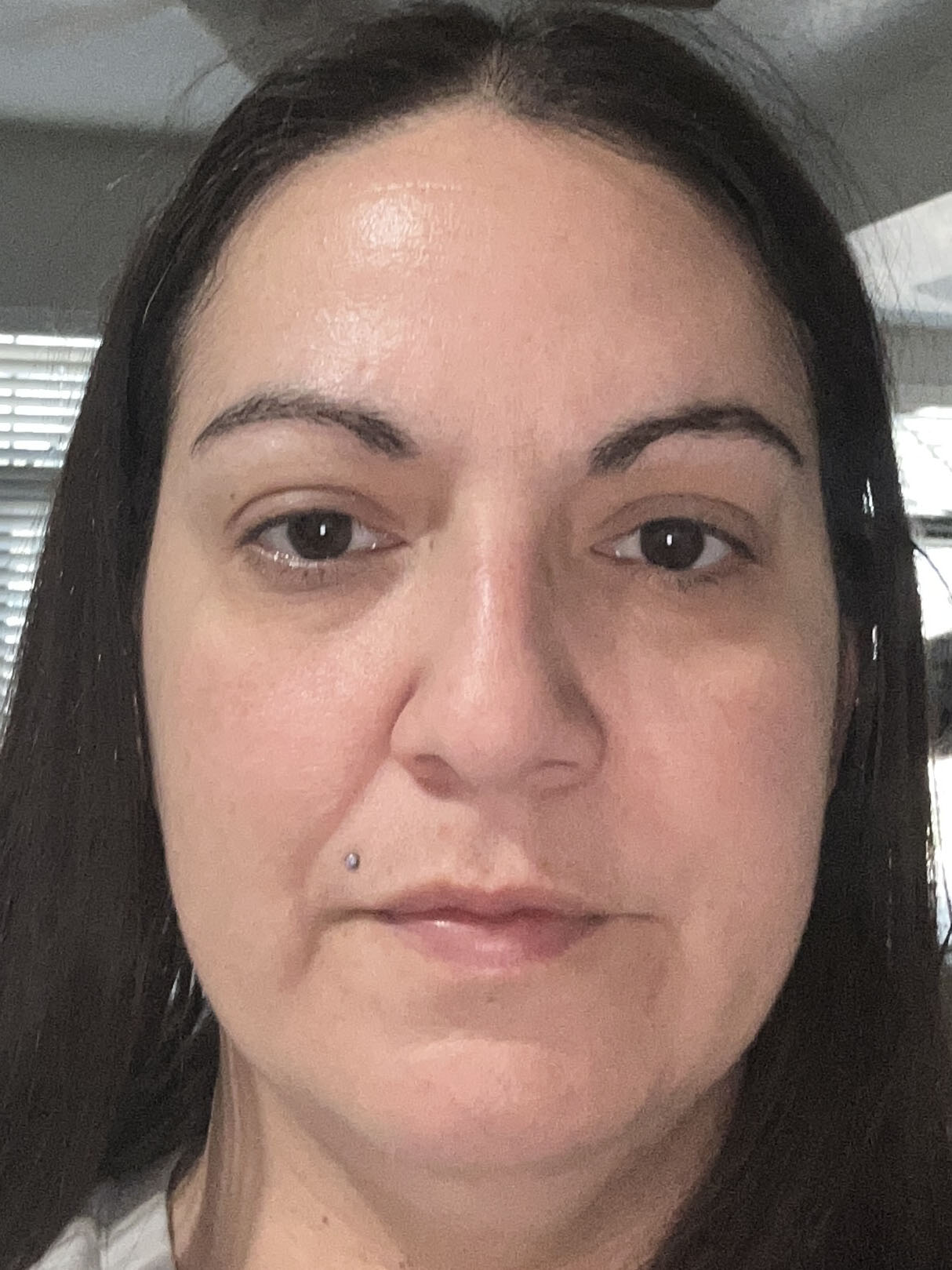 Ashley R., 40 After